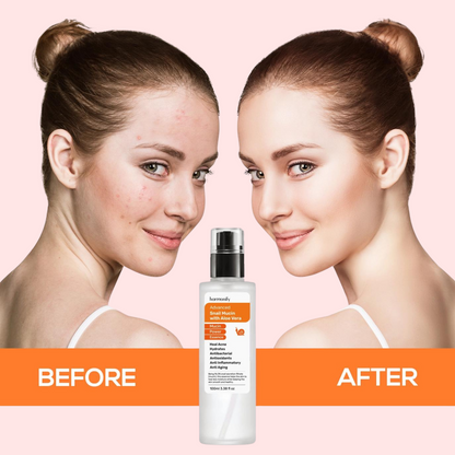 Advanced Snail 96 Mucin with Aloe Vera 100ml